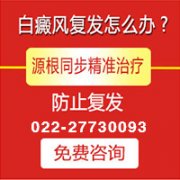 <b>面部白癜风应该怎么治疗呢？</b>