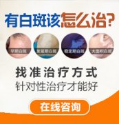 <b>白癜风有什么症状特点？</b>